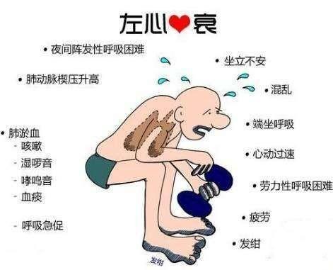 心梗最新治疗方法揭秘